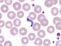 What is Chagas